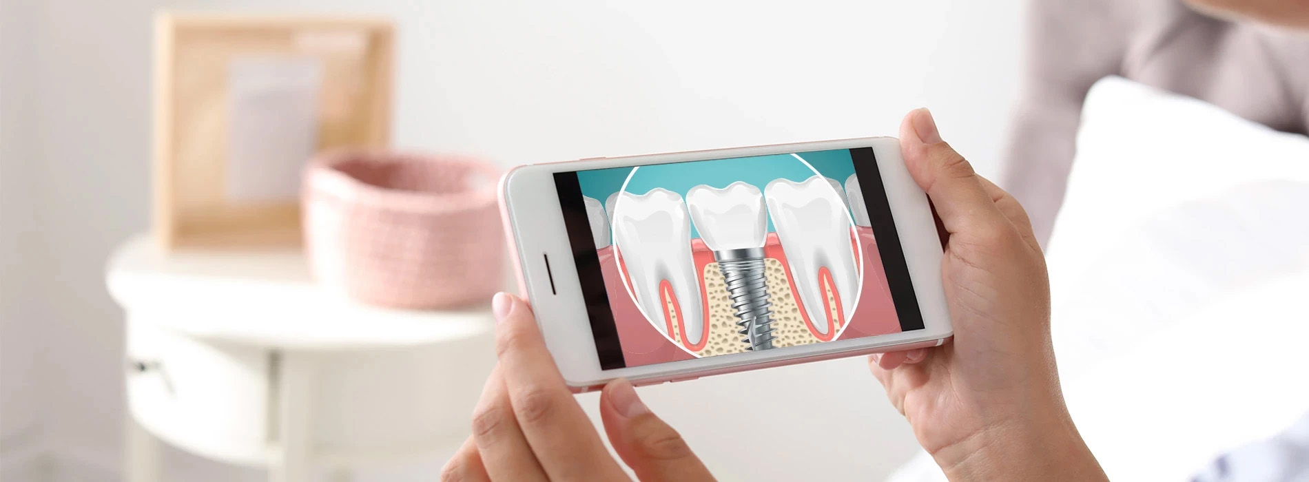 Dental Implants Dentist in Burbank IL