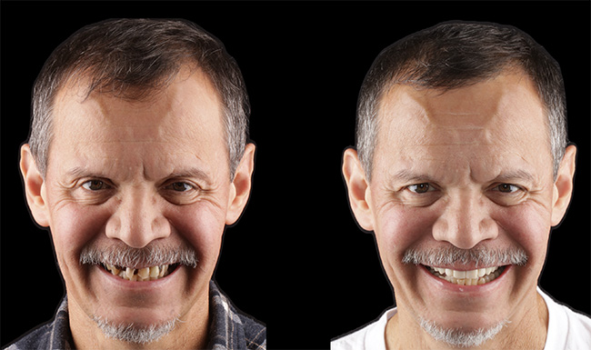 TruBlu Dentistry | Extractions, Implant Dentistry and Oral Exams
