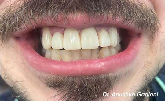 Burbank IL Cosmetic Dentist