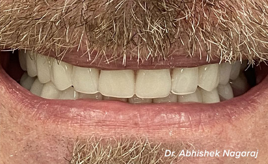 Family Dentist in Burbank IL