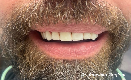 Family Dentist in Burbank IL