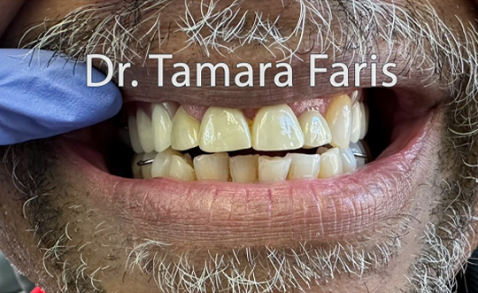 TruBlu Dentistry | E4D, Night Guards and Digital Radiography