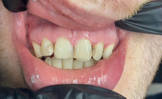 Dentist in Burbank IL