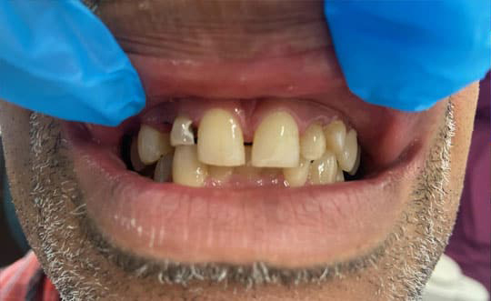 Family Dentist in Burbank IL