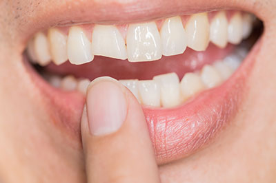 TruBlu Dentistry | Veneers, CBCT and Cosmetic Dentistry