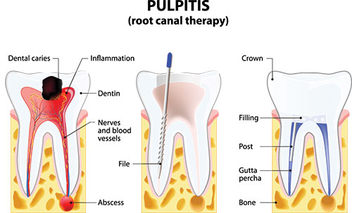 TruBlu Dentistry | Sleep Apnea, CBCT and E4D